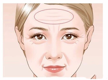 ?年紀輕輕?有了抬頭紋? ?年紀輕輕?有了抬頭紋?